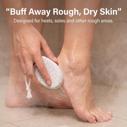 Nevoros - Volcanic Pumice Stone For Smoother, Softer Feet