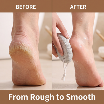 Nevoros - Volcanic Pumice Stone For Smoother, Softer Feet
